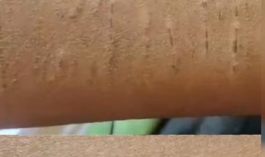 कुरूद: रोगटे खड़े कर देने वाली घटना,दहदहा स्कूल में 35 बच्चों ने 'काटे' हाथ; खुद को पहुंचाया नुकसान एक दूसरे को  किया चैलेंज